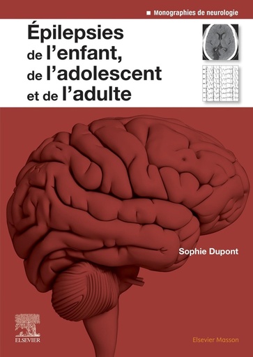 [8932596]  Epilepsies de l'enfant, de l'adolescent et de l'adulte 